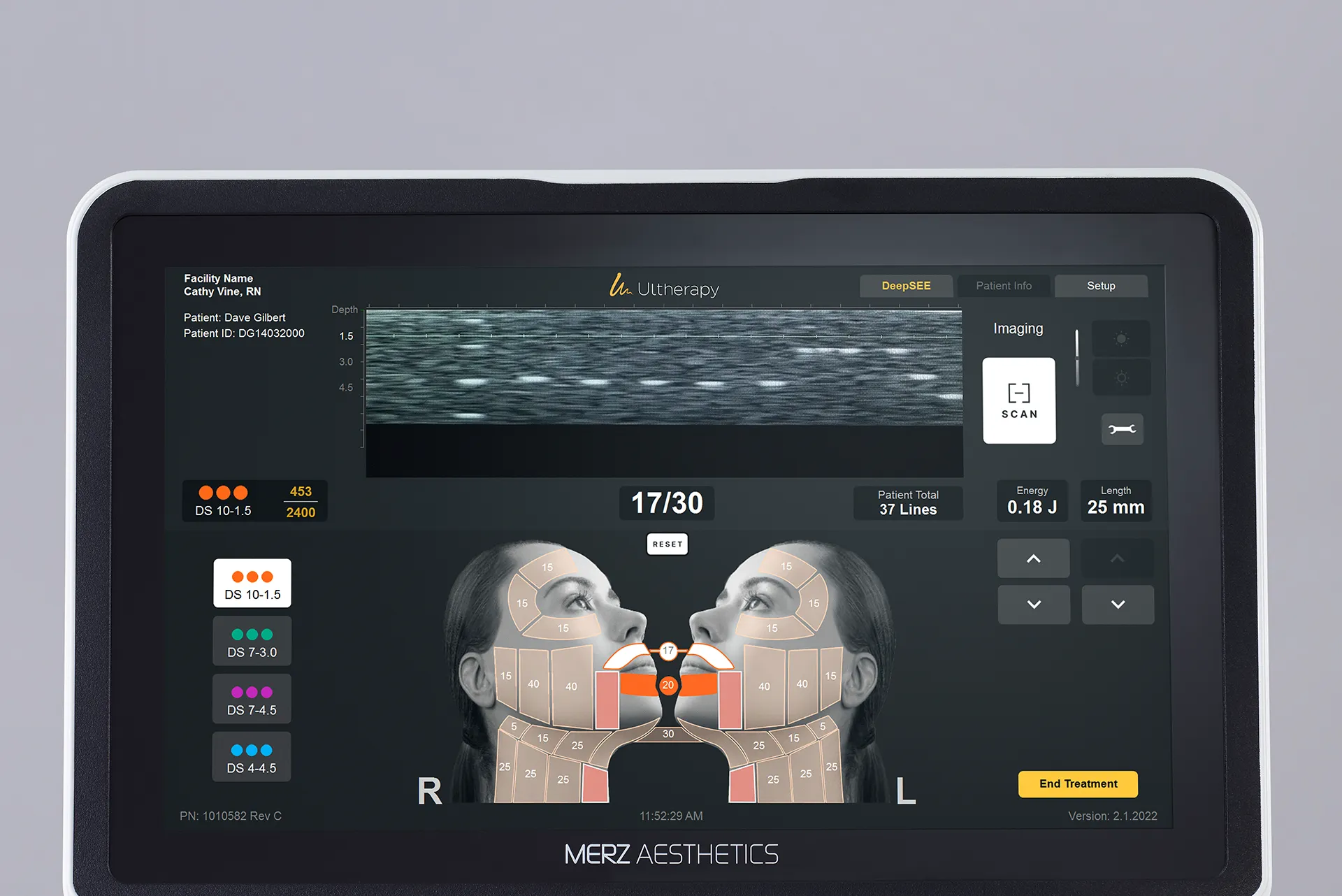 Monitor de Ultherapy PRIME® con tecnología de imagen vívida para tratamientos precisos, personalizados y consistentes.