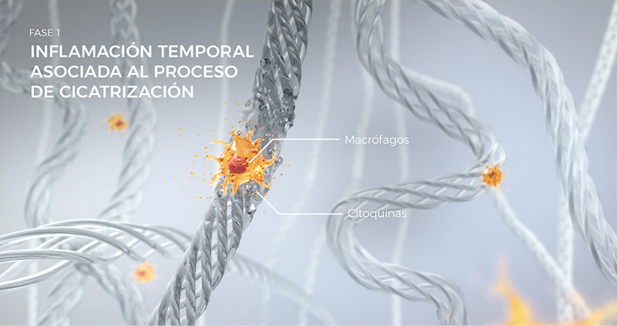Visualización de macrófagos durante la cicatrización de la Fase 1, mostrando inflamación temporal y reparación de tejido.